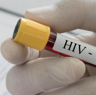 Заразата с ХИВ еволюира в нова посока