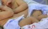 Малолетна роди сиамски близнаци, с общ таз са