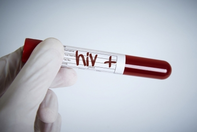Учени са открили съединение, което може да унищожи вируса ХИВ